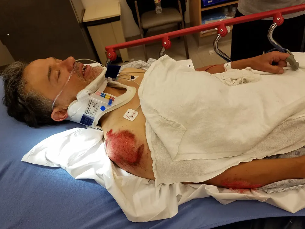 Bennett after the crash